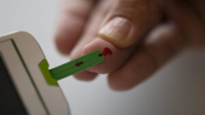 Do buyers accept sensor boxes near expiry showing a sealed CGM sensor box and expiration date